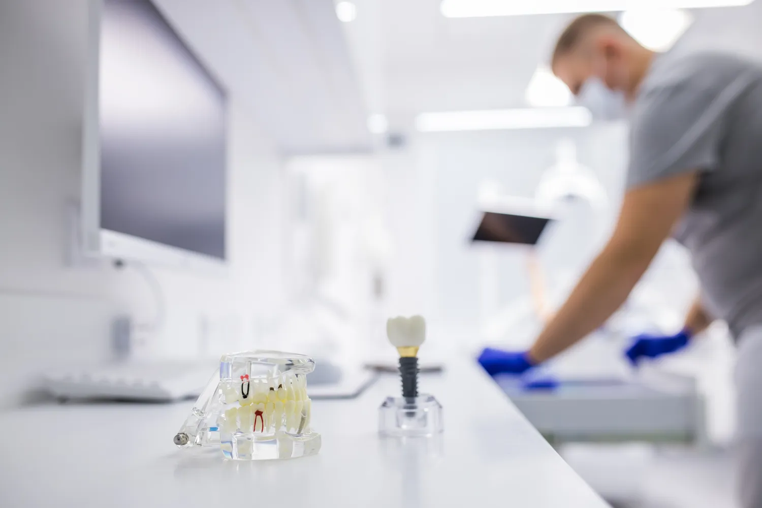 Ile kosztuje wymiana zębów na implanty?