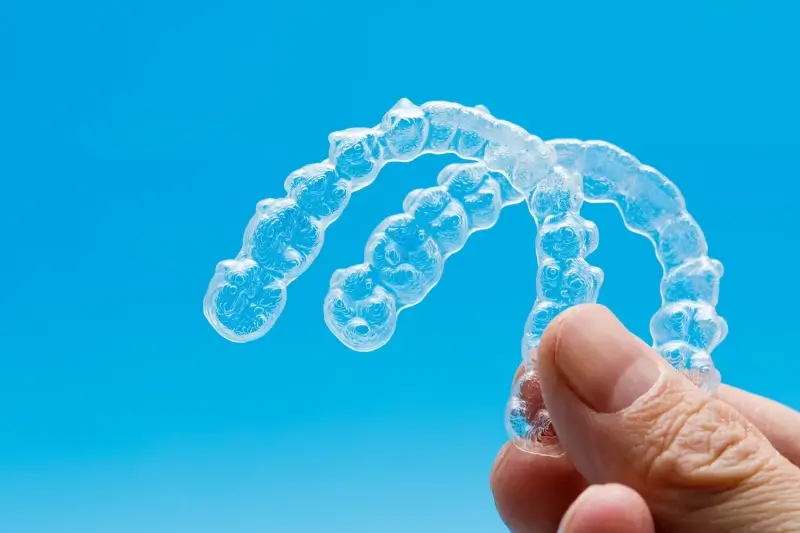 Prostowanie zębów metoda Invisalign